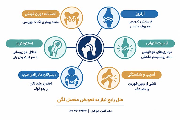علل رایج تعویض مفصل لگن شامل آرتروز، آسیب و استئونکروز