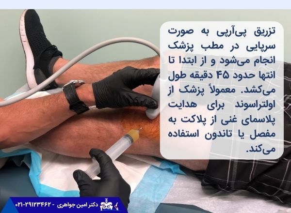 تزریق PRP چطور انجام می شود؟