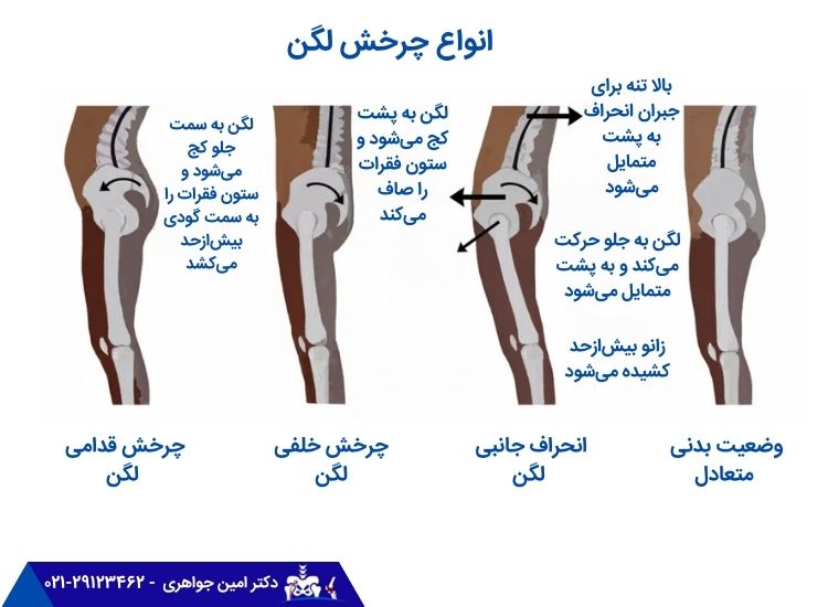 انواع چرخش لگن