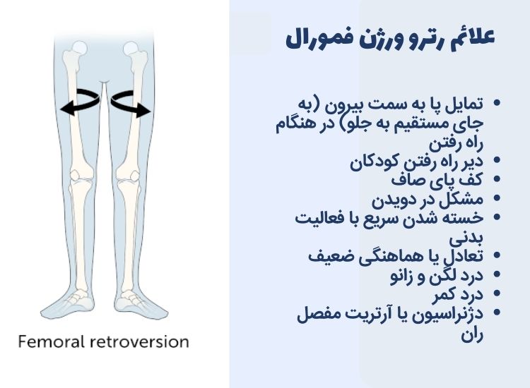 علائم چرخش ران به خارج