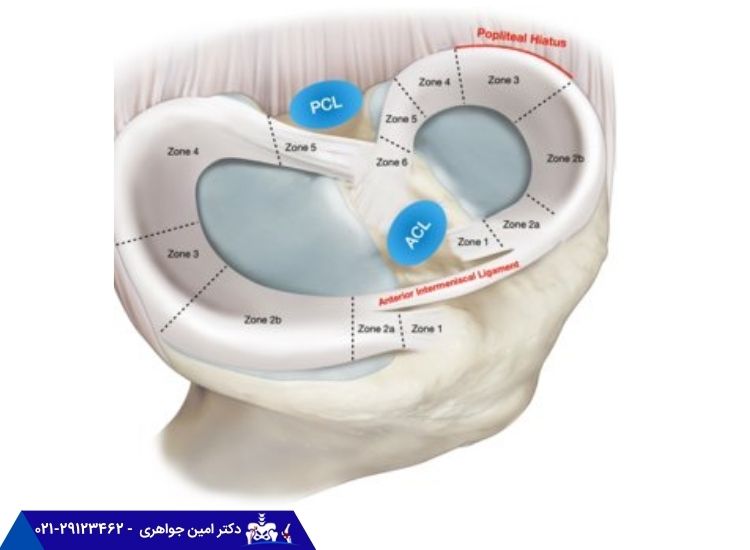 آناتوم منیسک داخلی