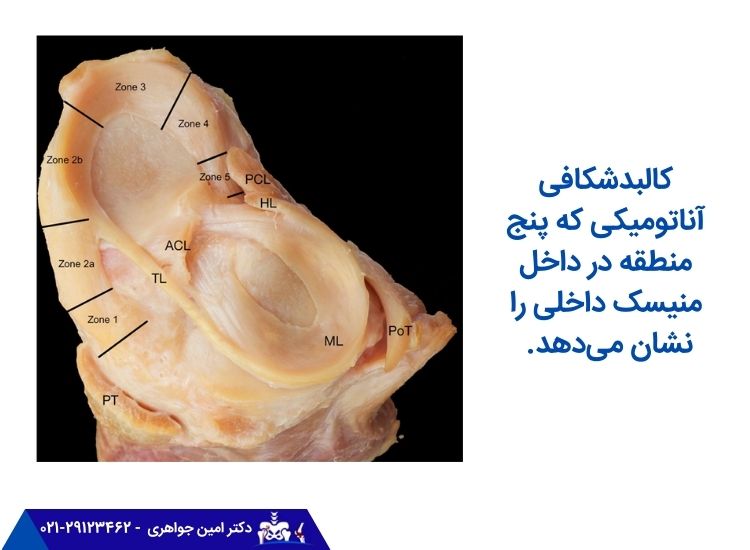 کالبدشکافی آناتومیکی منیسک داخلی زانو
