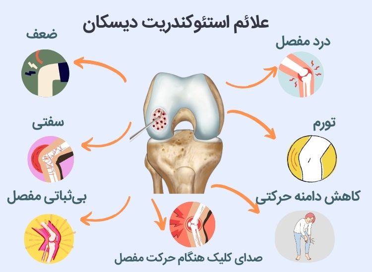 علائم استئوکندریت دیسکان