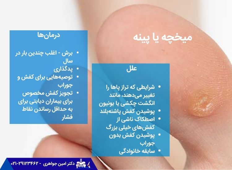 میخچه و پینه