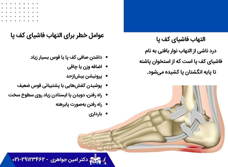 التهاب فاشیای کف پا