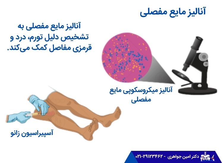 آنالیز مایع میان مفصلی