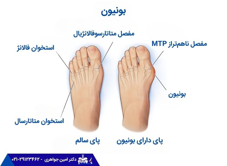 آناتومی پا