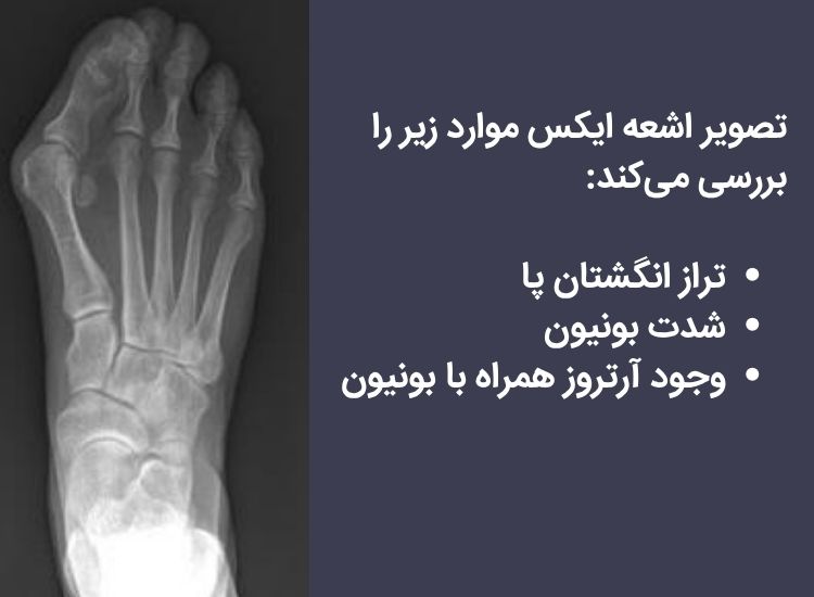 تشخیص با رادیولوژی