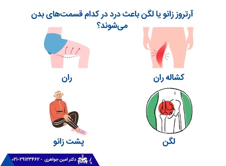 درد در قسمت های دچار آرتروز
