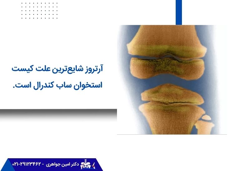 علت sbcs