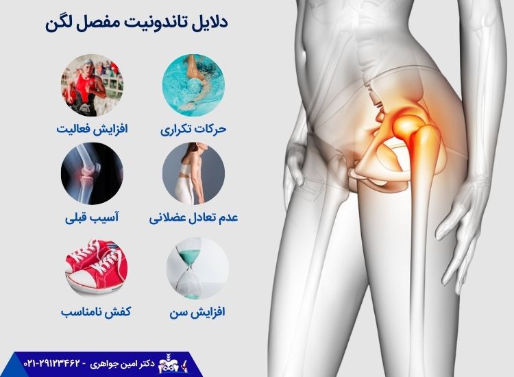 علت های تاندونیت لگن