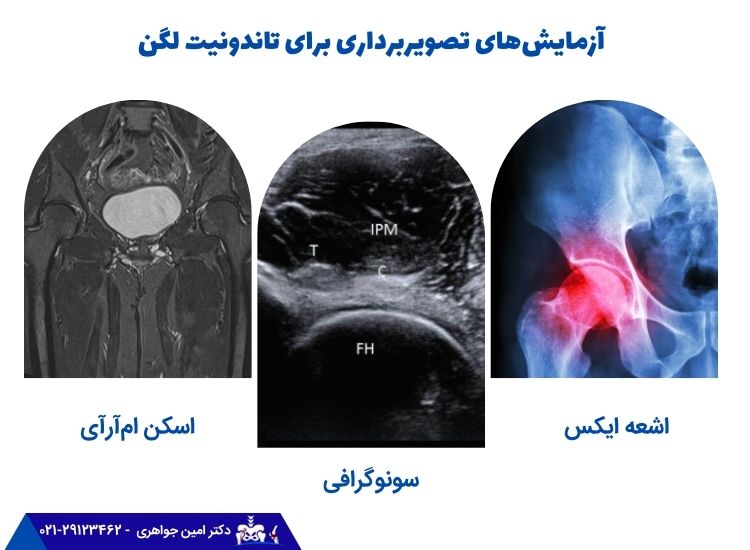 انواع تست های تشخیصی