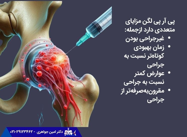 مزایای درمان لگن با پی آر پی