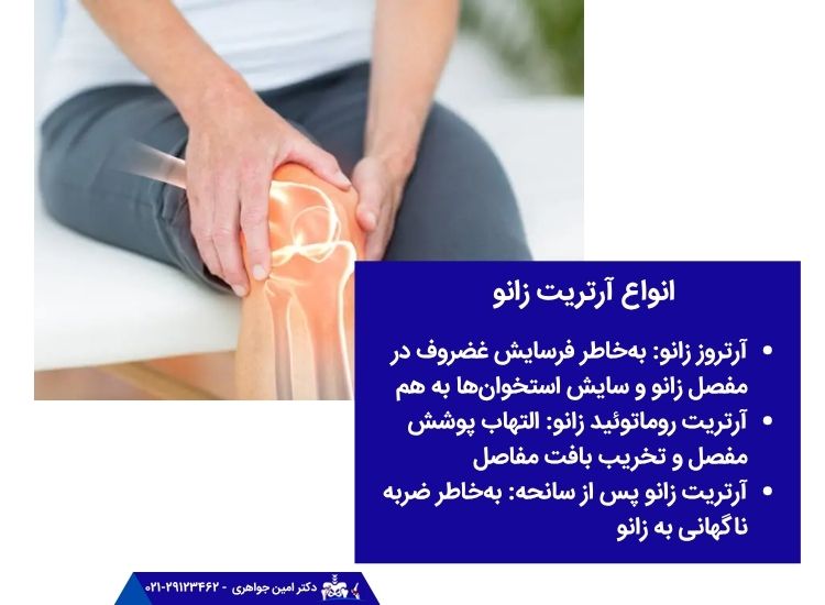 شایع ترین انواع آرتریت