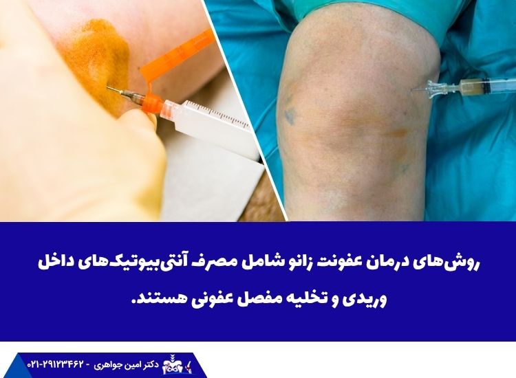 روش های درمان عفونت زانو