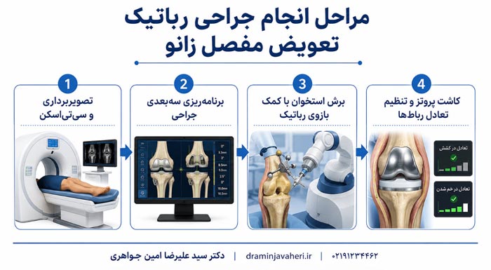 مراحل انجام جراحی رباتیک تعویض مفصل زانو