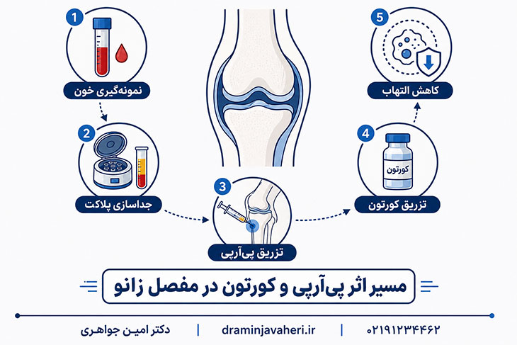 تفاوت مکانیسم اثر پیآرپی و کورتون در مفصل زانو