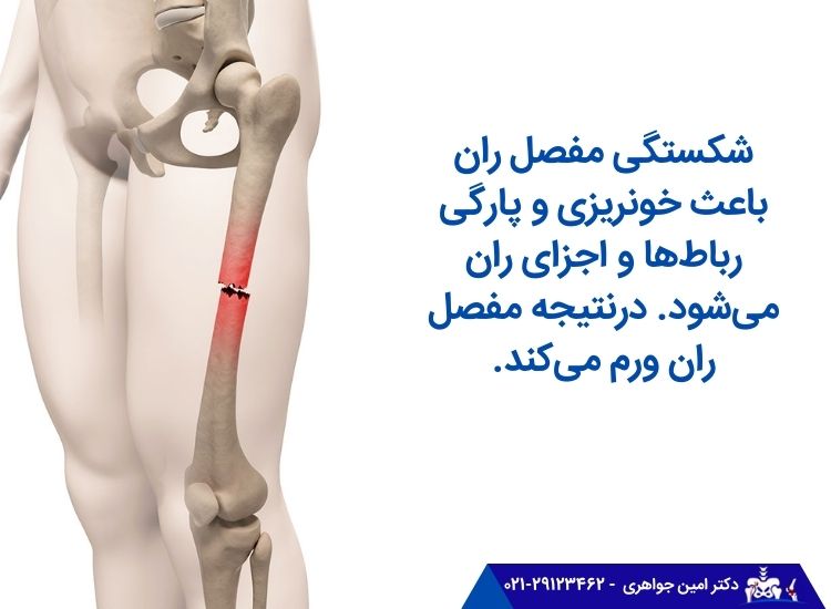 دلیل ورم مفصل ران