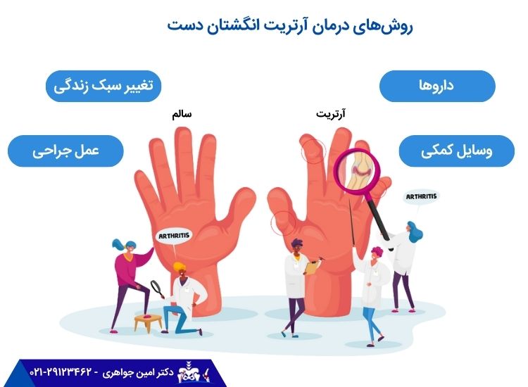 روش‌های درمان آرتریت انگشتان دست