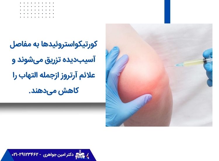 کورتیکواستروئیدها برای درمان آرتروز