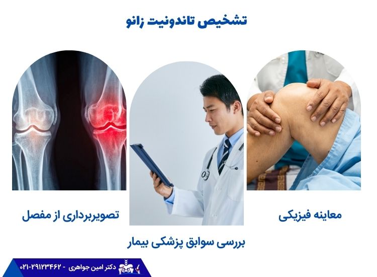 تشخیص تاندونیت زانو