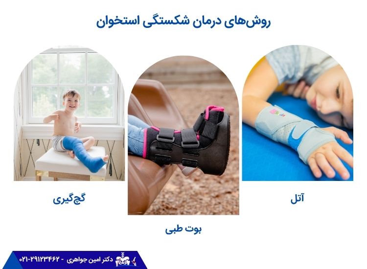 روش‌های درمان شکستگی استخوان در کودکان