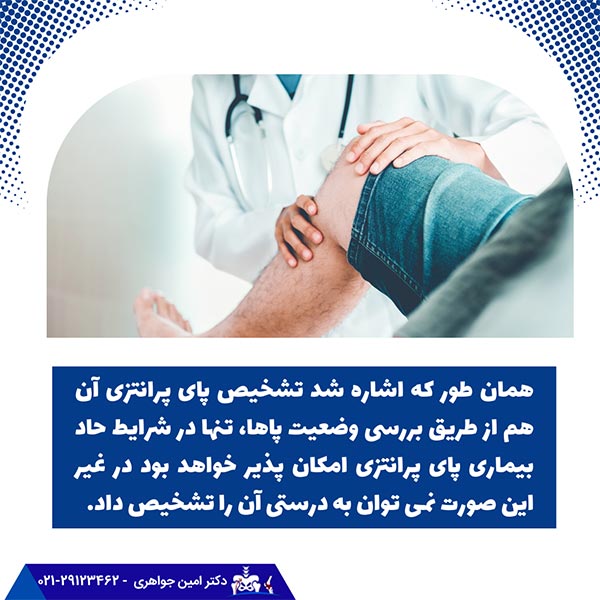 تشخیص پای پرانتزی توسط پزشک فوق تخصص زانو