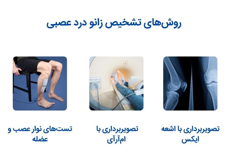 تشخیص زانودرد عصبی