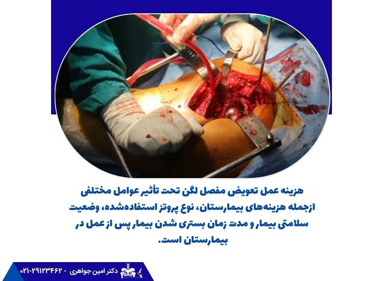 هزینه عمل تعویض مفصل لگن