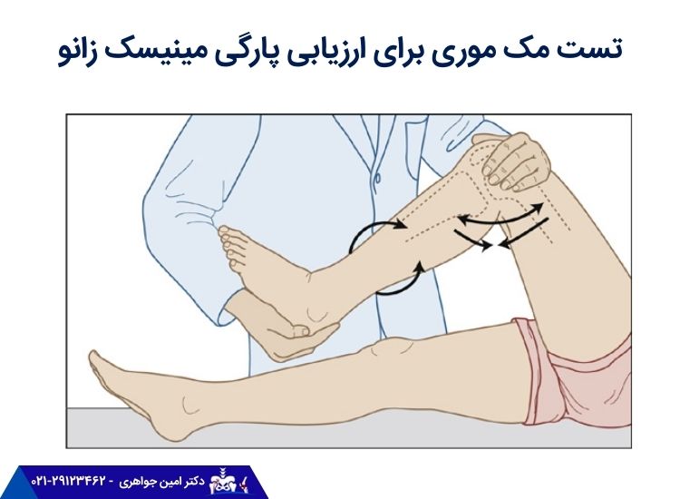 تست مک موری