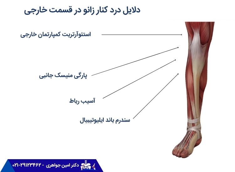 درد کنار زانو در قسمت خارجی