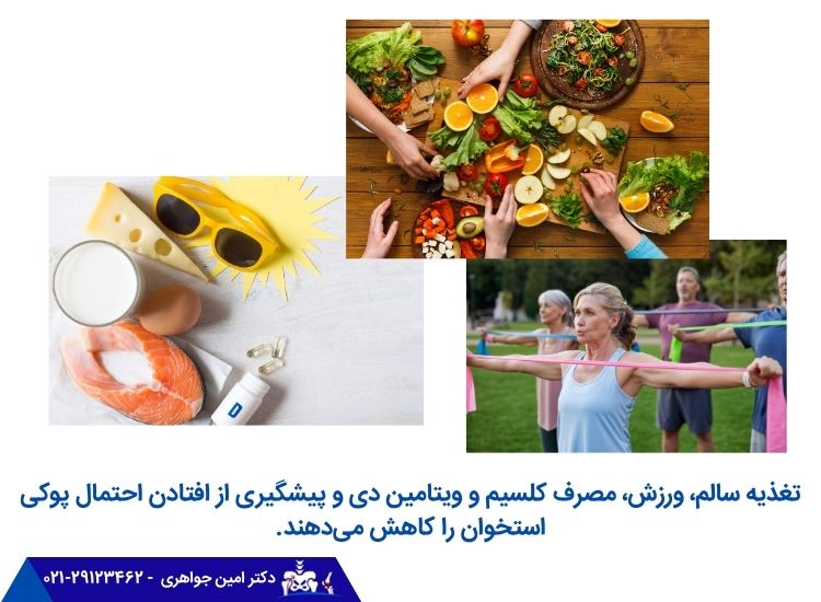 پیشگیری از پوکی استخوان