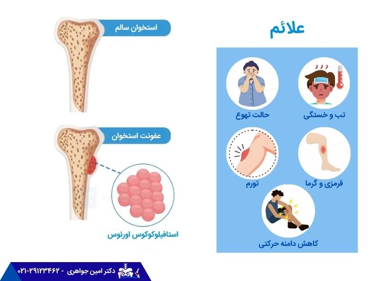 علائم عفونت استخوان