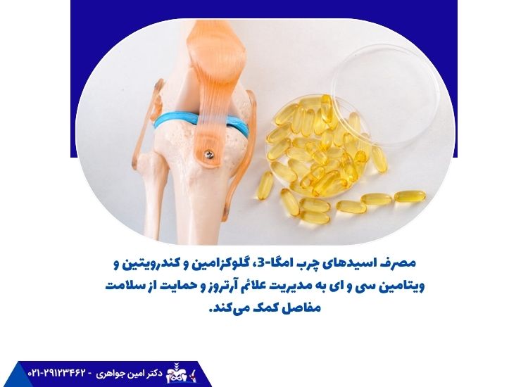 مصرف مکملها برای مدیریت علائم آرتروز