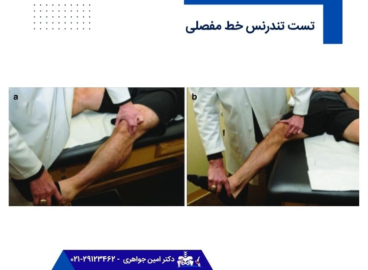 تست تندرنس خط مفصلی