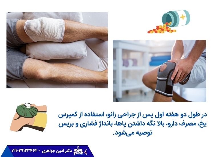 هفته اول تا دوم پس از جراحی منیسک زانو