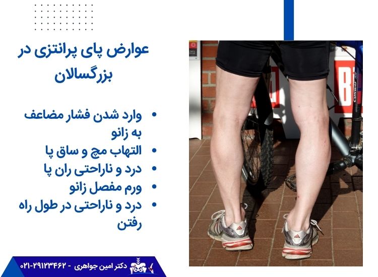 عوارض پای پرانتزی در بزرگسالان