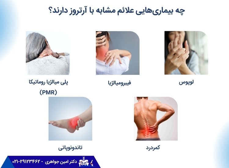 بیماری‌هایی که علائم مشابه با آرتروز دارند.