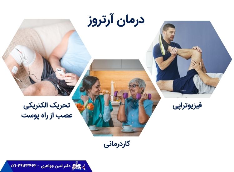 روش‌های درمان آرتروز