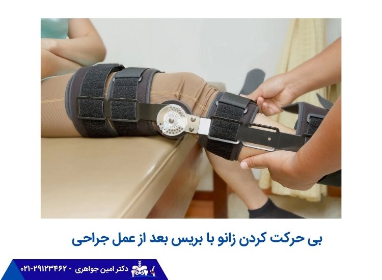 بی حرکت کردن زانو با بریس بعد از عمل جراحی