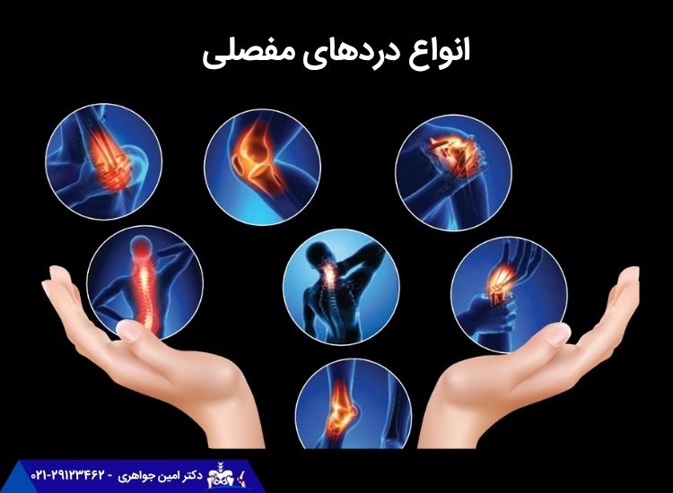 انواع درد مفصلی