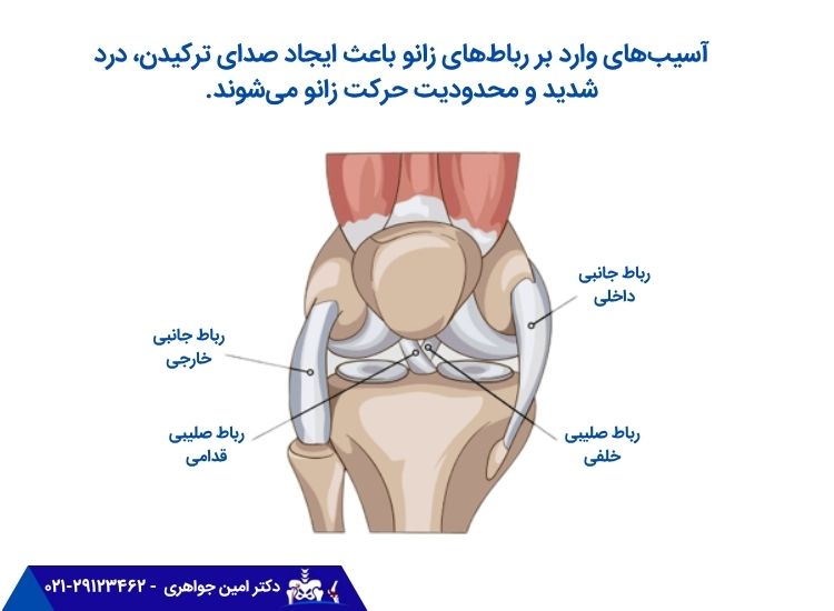 صدا دادن مفصل زانو به دلیل آسیبهای رباط زانو