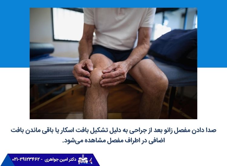 صدا دادن زانو بعد از جراحی