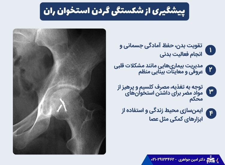 پیشگیری از شکستگی گردن استخوان ران