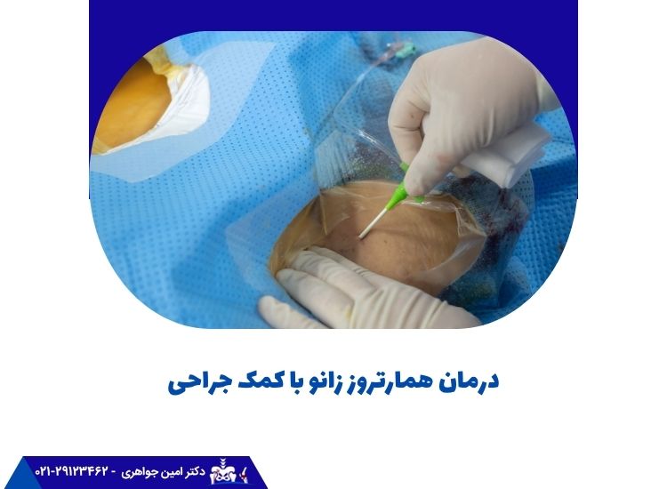 درمان همارتروز زانو با کمک جراحی