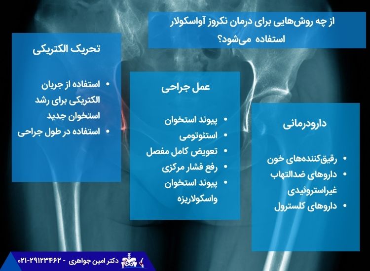 درمان نکروز استخوان