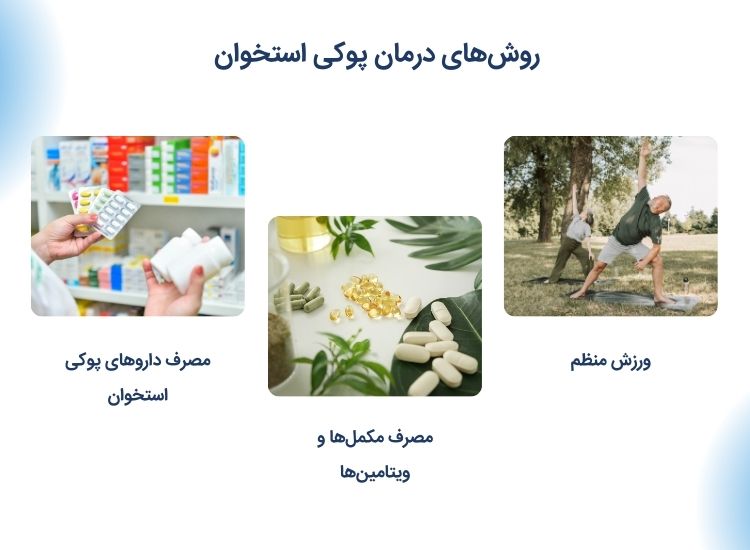 درمان پوکی استخوان