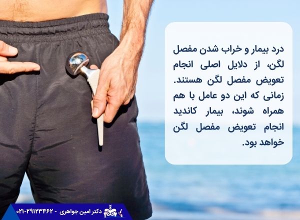 تعویض مفصل لگن