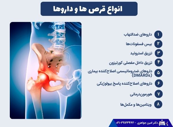 انواع قرص ها و داروهای درمان درد لگن