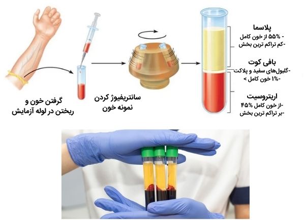 نحوه تهیه PRP